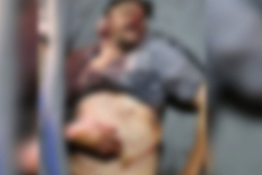 مقتل حارس مزرعة خلال محاولة سطو مسلح في مدينة داعل بريف درعا