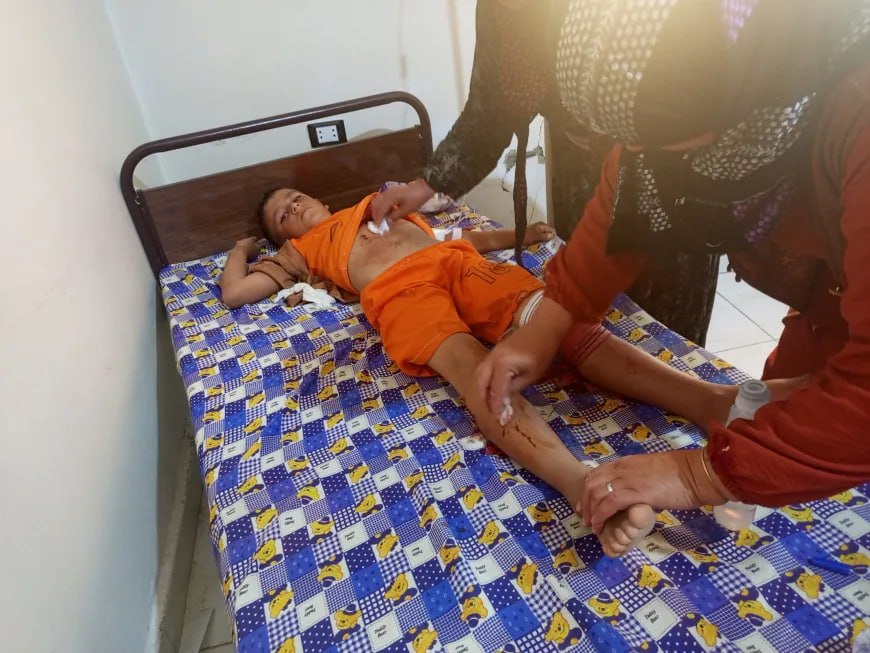 إصابة أطفال بانفجار لغم من مخلفات الحرب غرب تل تمر