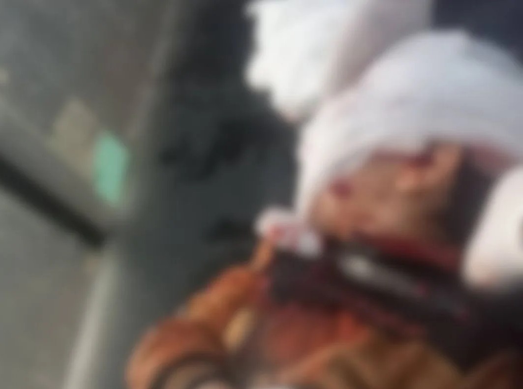 اصابة طفل في درعا