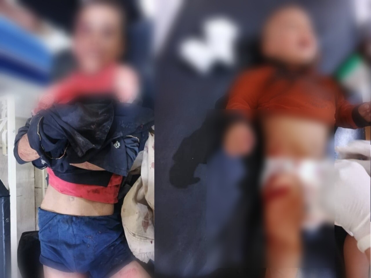 إصابة طفلين بانفجار لغم غربي دير الزور