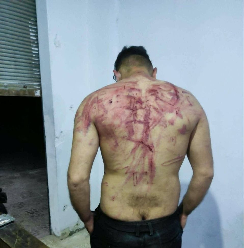 تعرض ست شبان للاعتداء في حمص